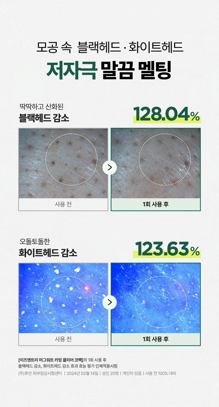 [피지멜팅 왕코팩] 이즈앤트리 머그워트 카밍 클리어 코팩 5매 상세페이지 7